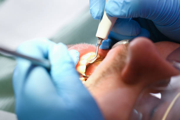 Best Broken or Cracked Tooth Emergency Dentist in Bellport, NY
