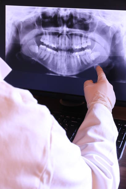 Best Broken or Cracked Tooth Emergency Dentist in Bellport, NY