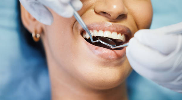 Best Emergency Dentist for Knocked-Out Tooth in Bellport, NY